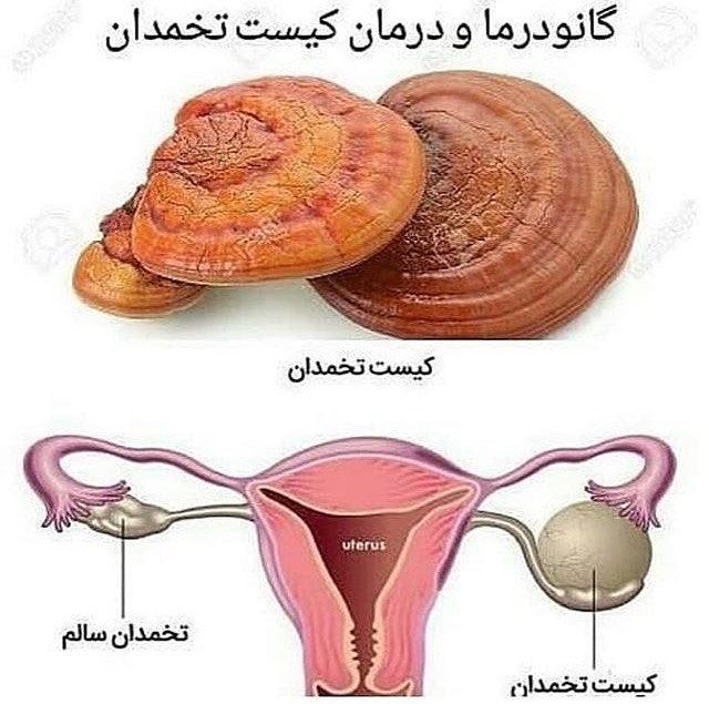 قهوه گانودرما برای تنبلی تخمدان خوبه؟