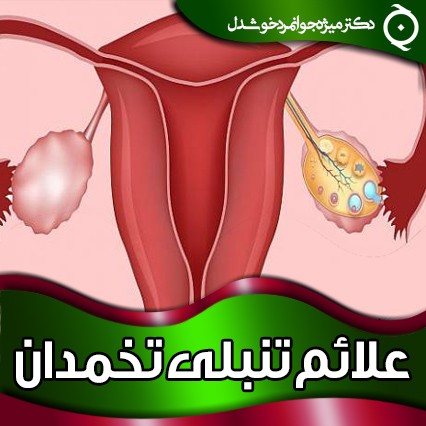 مهمترین علائم تنبلی تخمدان (سندروم تخمدان پلی کیستیک) - دکتر منیژه جوانمرد خوشدل