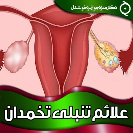 گانودرما | قهوه مهمترین علائم تنبلی تخمدان (سندروم تخمدان پلی کیستیک) - دکتر منیژه جوانمرد خوشدل
