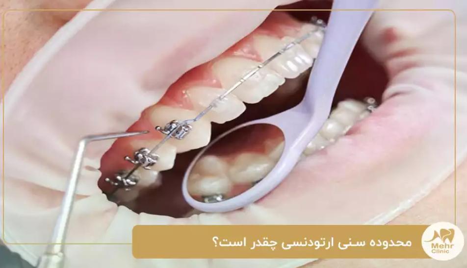 دندان پزشکی کلینیک دندانپزشکی مهر شریعتی؛ مشاوره تخصصی ارتودنسی برای تمام محدوده های سنی